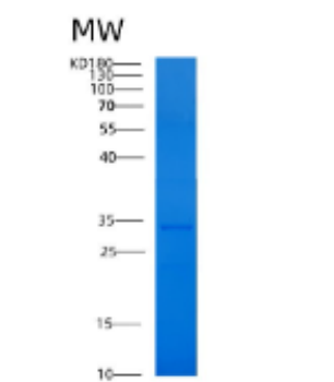 Recombinant Human 14-3-3 η/ YWHA1 Protein