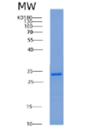 Recombinant Human 14-3-3 ζ/YWHAZ Protein