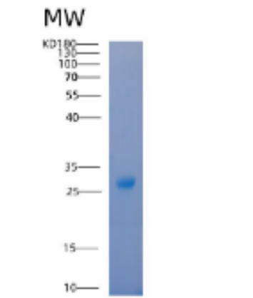 Recombinant Human 14-3-3 β/YWHAB Protein