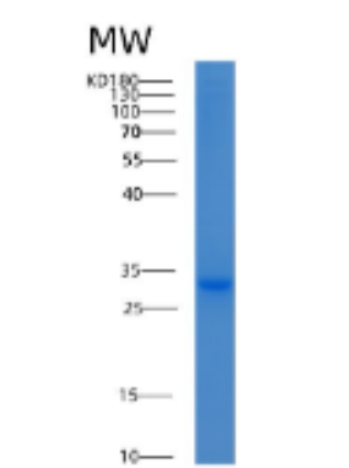 Recombinant Human 14-3-3 eta/YWHAH Protein