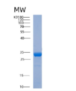 Recombinant Human ABHD10 Protein