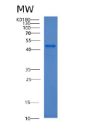 Recombinant Human ACAT1 Protein