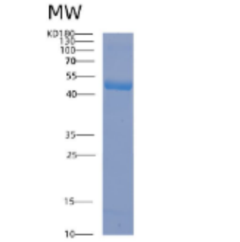 Recombinant Human ACADL Protein