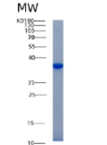 Recombinant Mouse Akr1b1 Protein