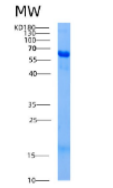 Recombinant Human AK5 Protein