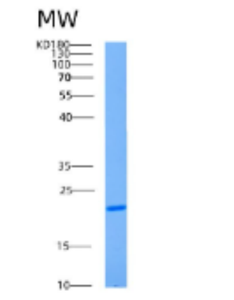 Recombinant Human AK1 Protein