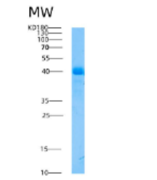 Recombinant Human AHSG Protein