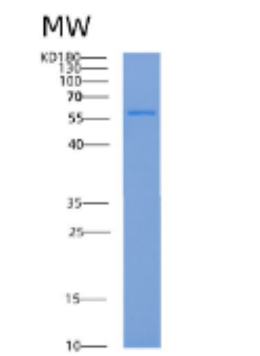 Recombinant Human ADSL Protein