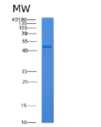 Recombinant Human ADPRH Protein