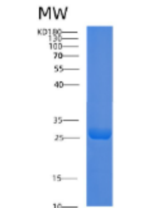 Recombinant Mouse Adiponectin Protein