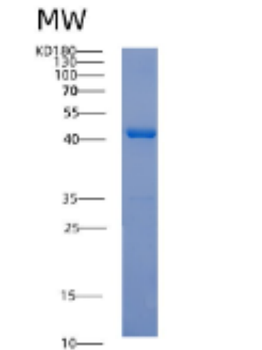 Recombinant Human ACTA2 Protein