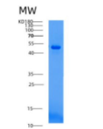 Recombinant Human ACP6 Protein