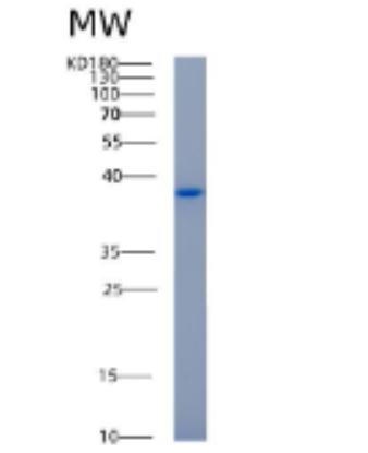 Recombinant Human AKR1C1 Protein