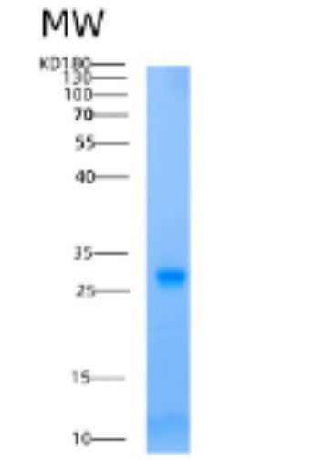 Recombinant Human AK2 Protein