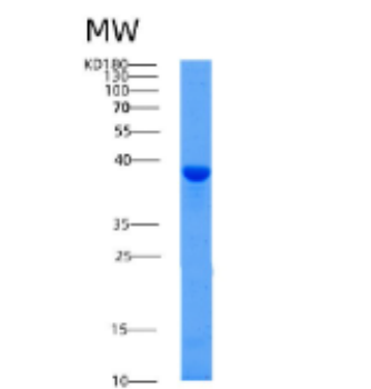 Recombinant Human AFAP1 Protein