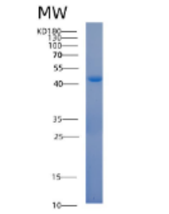 Recombinant Human ACOT7 Protein