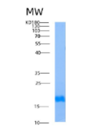 Recombinant Human AIMP3 (Aminoacyl tRNA synthetase complex-interacting multifunctional protein 3) Protein