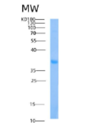 Recombinant Human AIDA Protein