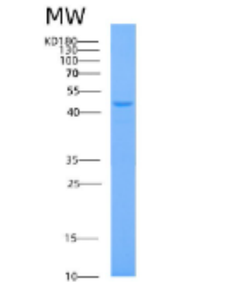 Recombinant Human AHCY Protein