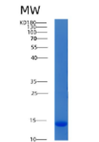 Recombinant Human ACYP1 Protein