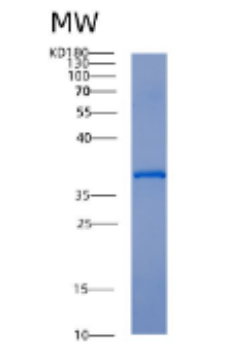 Recombinant Human Activator of Hsp90 ATPase-1 /AHA1 Protein