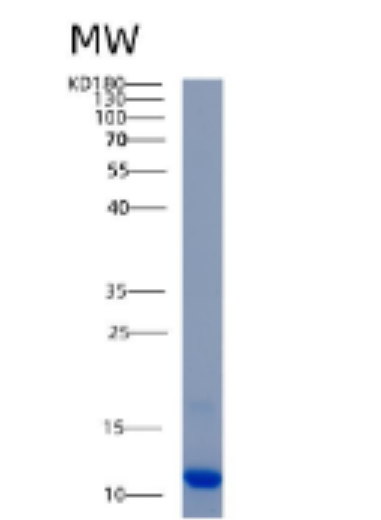 Recombinant Human AKAP7 Protein