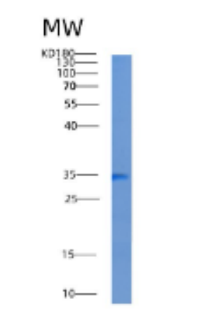 Recombinant Human ADAL Protein