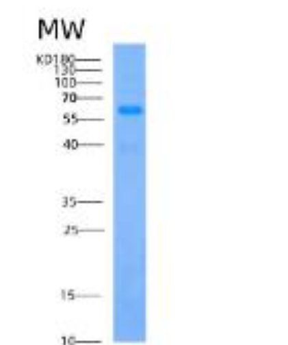 Recombinant Human ACSF2 Protein