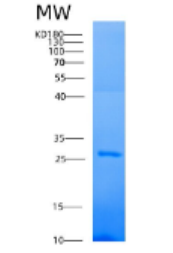 Recombinant Human AK4 Protein