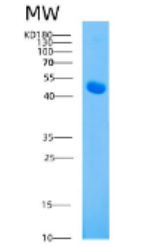 Recombinant Mouse ahsg Protein