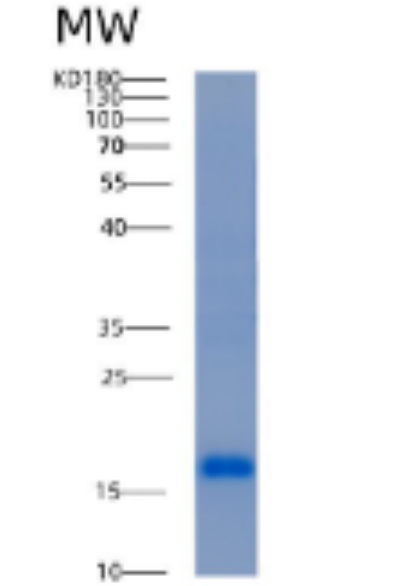 Recombinant Human ACOT13 Protein