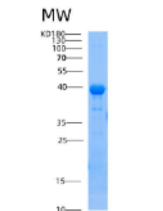 Recombinant Human AIP Protein
