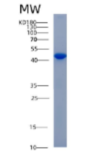 Recombinant Human ADH6 Protein