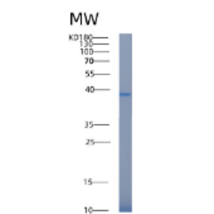 Recombinant Human AKR1C3 Protein