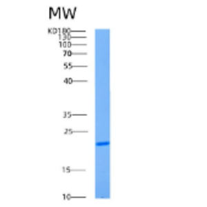 Recombinant Human AK1 Protein