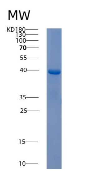 Recombinant Human AKR1C4 Protein