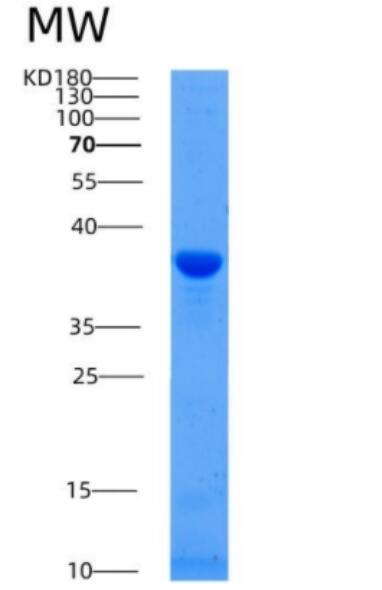 Recombinant Human ALAD Protein