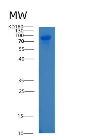 Recombinant Human ALCAM Protein