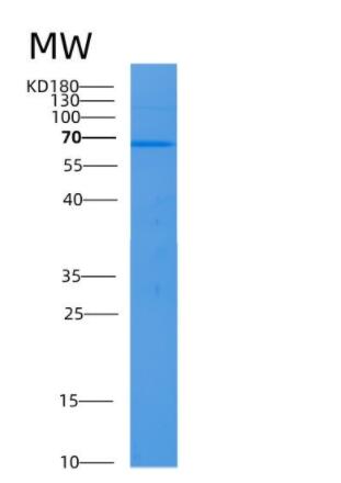 Recombinant Human ALB Protein