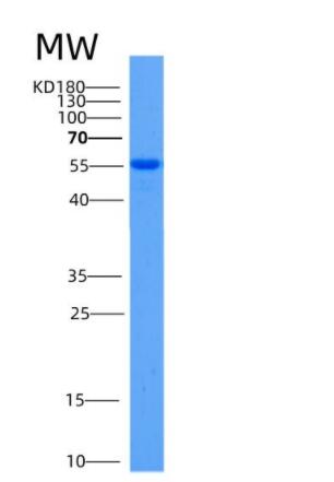 Recombinant Mouse Aldh2 Protein