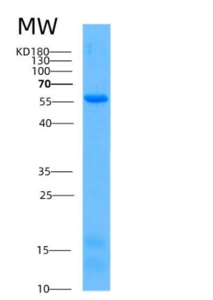 Recombinant Human AKT1 Protein