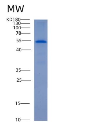 Recombinant Human ALDH6A1 Protein