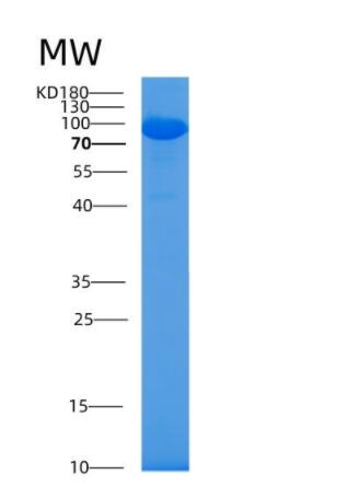 Recombinant Human AlaRS (Alanyl-tRNA synthetase) Protein