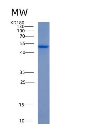 Recombinant Human ALDH3A1 Protein