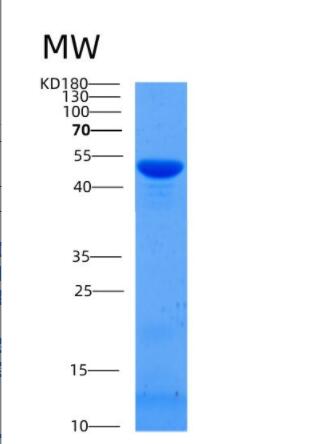 Recombinant Human Alkaline phosphatase Protein