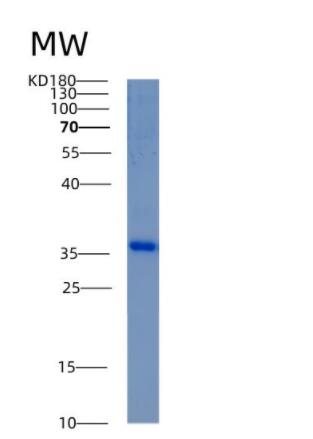 Recombinant Human Aldo-keto reductase family 1 member C3 isoform 1 Protein