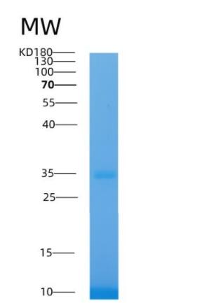 Recombinant Human Aldose reductase Protein