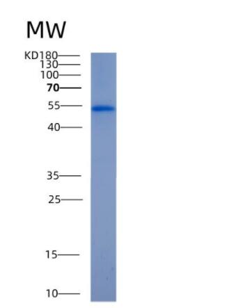 Recombinant Human ALDH2 Protein
