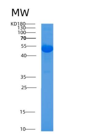 Recombinant Mouse Alpl Protein