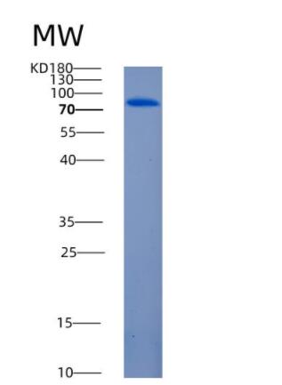 Recombinant Rat Angiotensin-converting enzyme 2 Protein